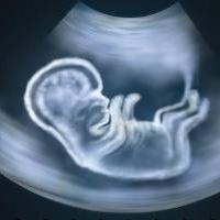 At what date does ultrasound show pregnancy?