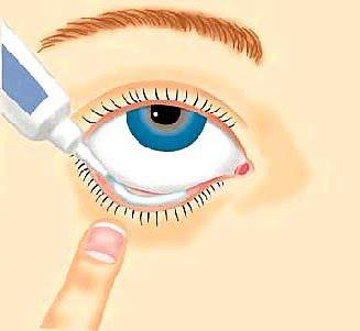 Eye ointment for conjunctivitis for children and adults