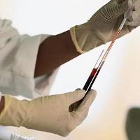 The norm of the blood test, what is its significance