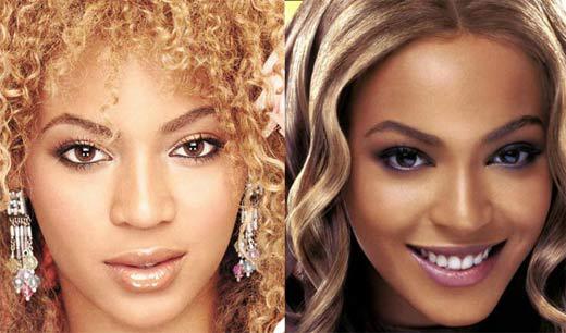 Stars before and after plastic surgery (photo)